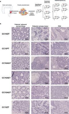 Turmeric Is Therapeutic in Vivo on Patient-Derived Colorectal Cancer Xenografts: Inhibition of Growth, Metastasis, and Tumor Recurrence